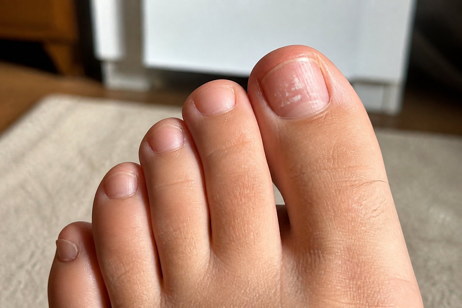Pourquoi ton ongle de pied blanchit soudainement ?