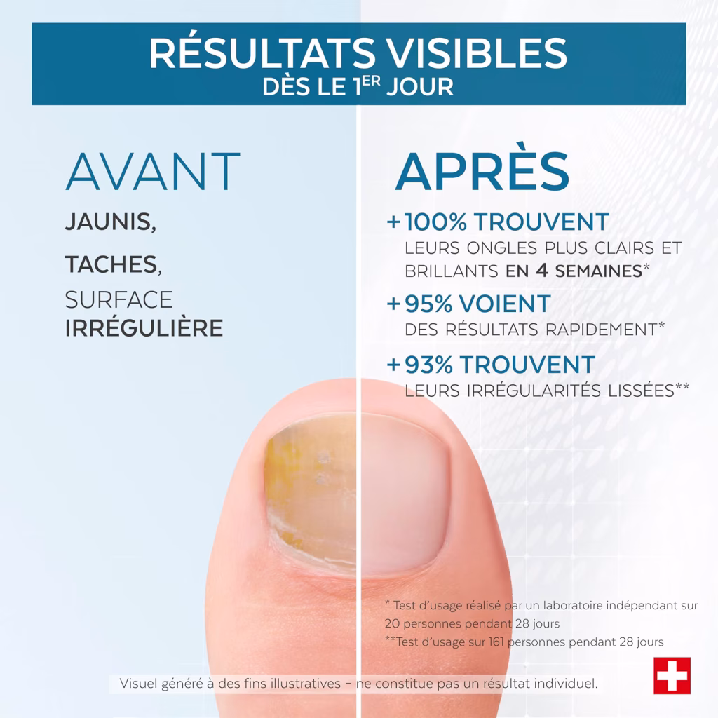 Vernis blanchissant Poderm